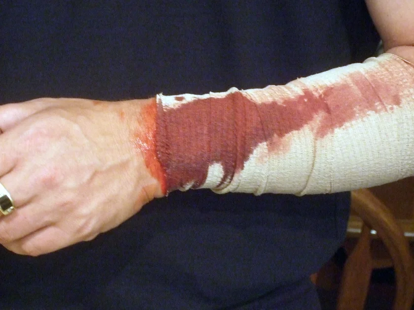 Michael Gull as Otto.